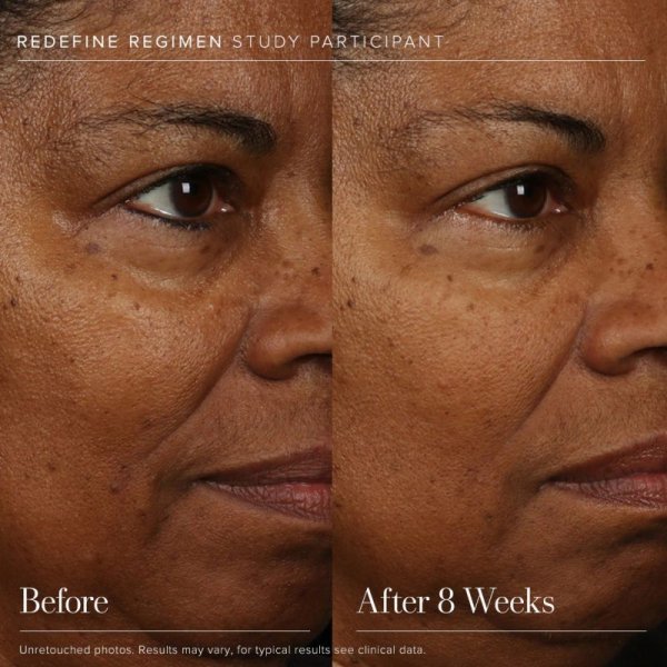 画像3: Rodan and Fields REDEFINE REGIMEN R + F ロダン アンド フィールズ リディファインレジメン 基礎化粧品セット (3)