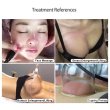 画像6: Vacuum Therapy Butt Lifting Breast Enlargement Machine 胸 お尻 マッサージ ポンプリフティング 真空吸引カッピング 吸引デバイス 美容機器 美顔器  (6)