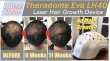 画像4: セラドーム ヘルメット型 低出力レーザー器 Theradome EVO LH40 Laser Hair Growth Device (4)