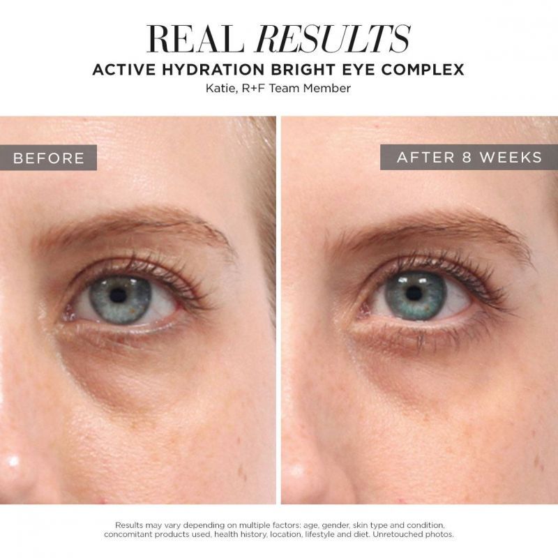 Rodan and Fields ACTIVE HYDRATION BRIGHT EYE COMPLEX R + F ロダン アンド フィールズ  アクティフハイトレーションフライトアイコンフレックス